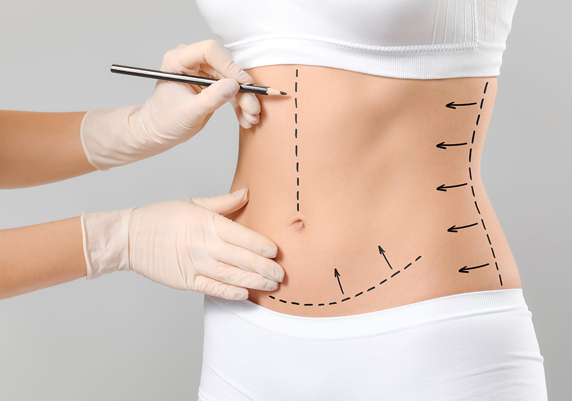 tummy tuck surgery in turkey